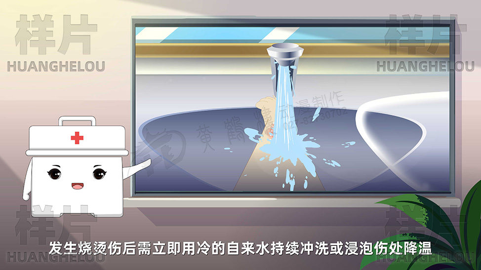 如果伤处仅出现红斑，轻度红、肿、热、痛，需立即用冷的自来水持续冲洗或浸泡伤处降温.jpg