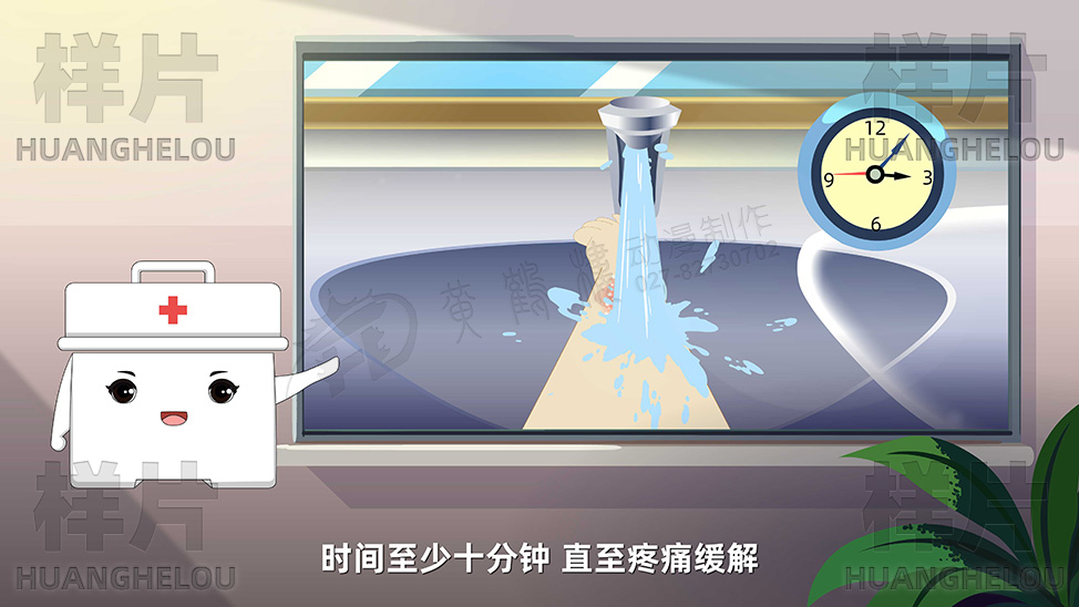 之后可以根据情况涂抹烫伤膏，但是不能涂抹牙膏、酱油、醋等任何东西.jpg