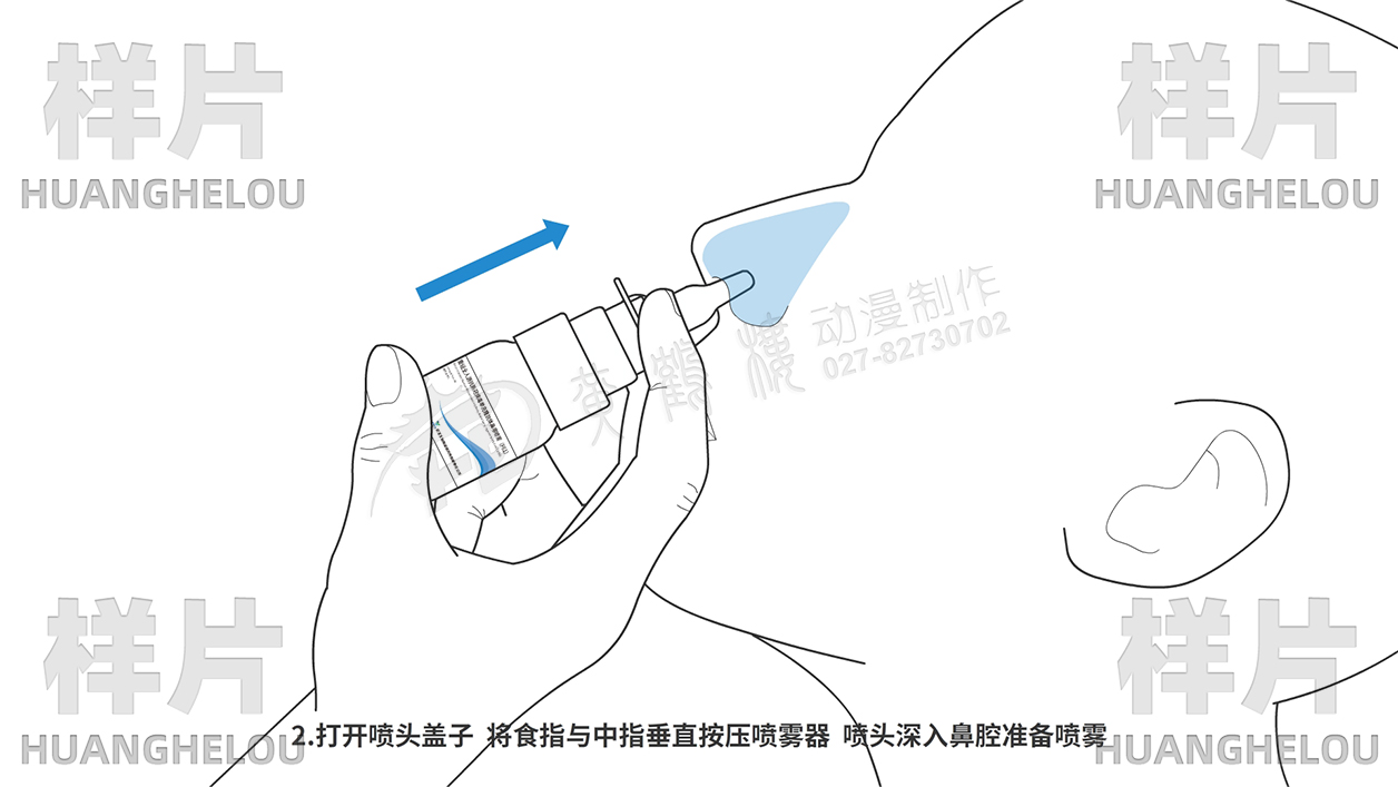 喷头深入鼻咽部.jpg