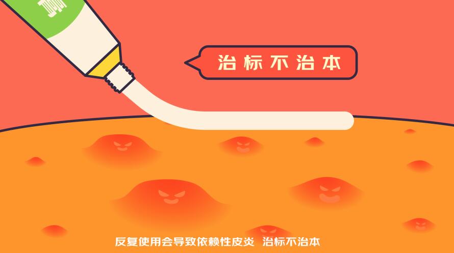 反复使用会导致依赖性皮炎，治标不治本.jpg